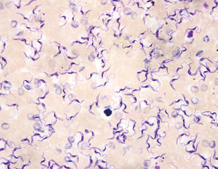 Fototapeta premium Trypanosomes are protozoa that burrow into the tissues of other organisms and feed on blood, causing Chagas disease and sleeping sickness in humans.Magnified 1000x 