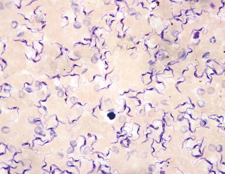Trypanosomes are protozoa that burrow into the tissues of other organisms and feed on blood, causing Chagas disease and sleeping sickness in humans.Magnified 1000x
