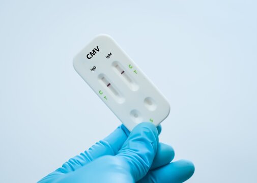 Blood sample of patient negative result for cytomegalovirus (CMV).