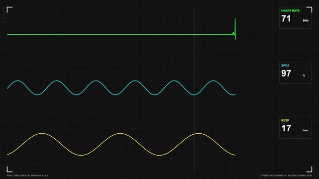Medical Monitor Interface with Heart Rate Flatline and Stable Status