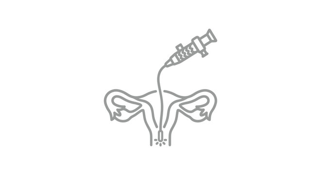 Medical illustration of intrauterine insemination procedure, fertility treatment concept, line art icon of uterus and syringe