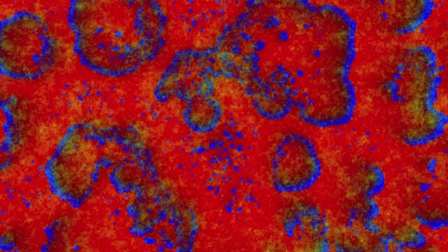 Highly saturated cellular and microbiological patterns. The visual effect resembles fluorescence microscopy imagery, displaying the growth of bacteria, 