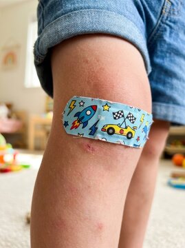 Kid with adhesive bandage on knee. Child leg with colorful medical plaster featuring rocket and car pattern. Childhood injury, healthcare, treatment and safety protection concept.