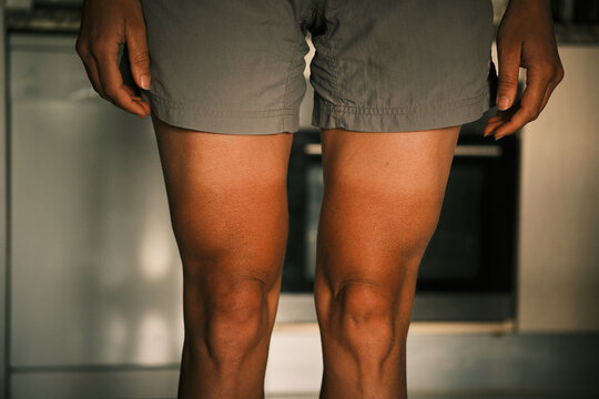 Close-up of a person's legs displaying prominent tan lines from wearing shorts, clearly showing the contrast between sun-exposed and covered skin after outdoor activity.