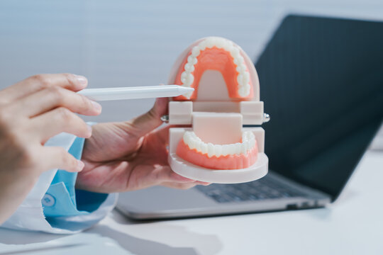 Dental model showing teeth and jaw for oral care consultation with hand pointing beside laptop in clinic office