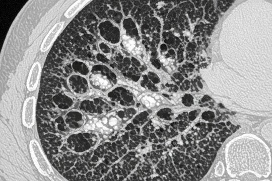 Close-up image of the interior of the human stomach, highlighting its layers and structure