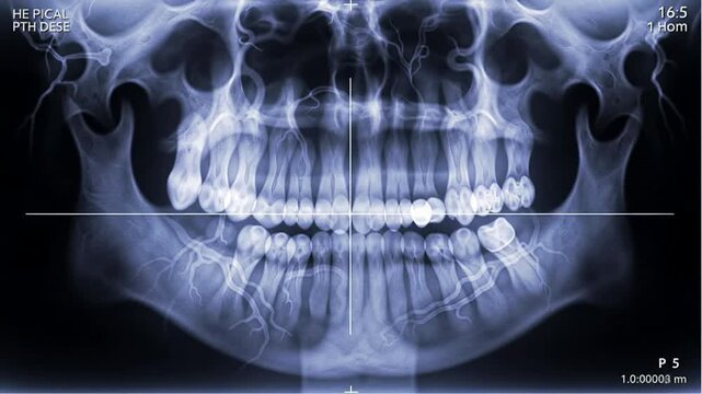 Detailed Dental X-Ray Anatomical View Of Transparent Jaw Roots And Teeth For Medical And Educational Use