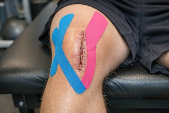 A person wearing pink and blue tape on their knee, possibly for injury rehabilitation or sports training