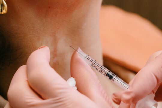 La jeringa de botox en cuello detalle 