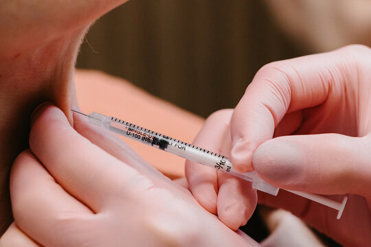 Las manos aplicando botox en cuello de mujer 