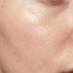 Fototapeta premium Macro photograph of human cheek skin with moisturizing glow