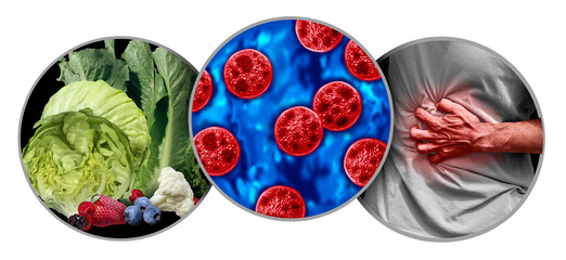 Cyclosporiasis Symptoms as a parasitic disease as a foodborne parasite illness caused by Cyclospora...