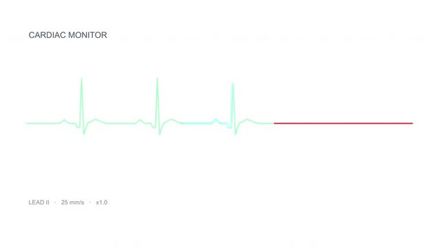 Heartbeat line flatlines signifying critical medical emergency and cardiac arrest danger