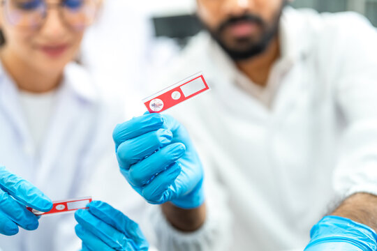 Researchers closely inspecting a red specimen slide held in gloved hand, focused medical analysis in laboratory.