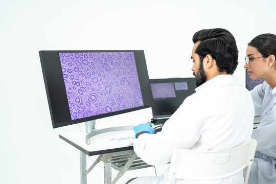 Researchers studying a purple microscopy image of cells on a large screen, digital pathology and histology analysis in bright lab.