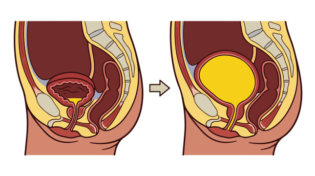 Human bladder anatomy vector illustration, sagittal cross section of empty and full urinary bladder, medical diagram of female pelvic organs