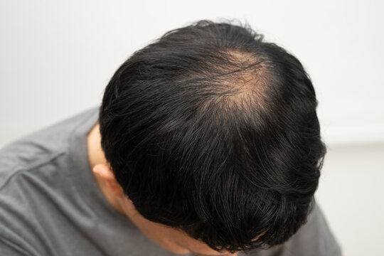 Bald in the middle head and begin no loss hair glabrous of mature Asian business smart active office man.