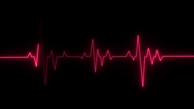 Cardiac arrest on the medical monitor, heart stops beating. Abstract heartbeat and pulse rate signal technology animation on grid background. Heart beat pulse.