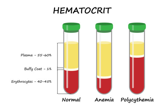 Hematocrit. Medical illustration.