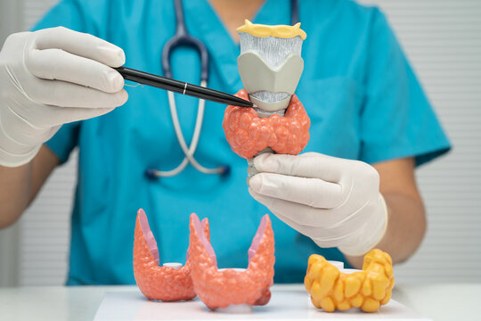 Hyperthyroidism, Overactive Thyroid, Thyroid Lymphoma, Asian doctor with thyroid gland human anatomy model in hospital.