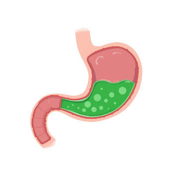 Medical of a human stomach organ showing internal green liquid contents isolated on black background isolated on a transparent background
