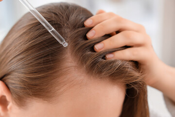 Woman applying hair serum to scalp with dropper, hair care and treatment for healthy hair growth