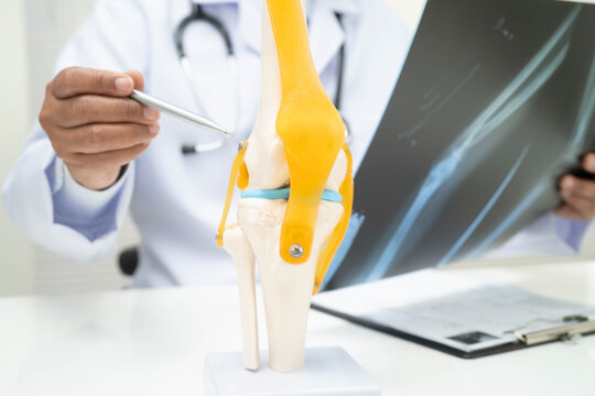 Doctor examining knee joint bone radiography xray film.