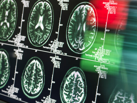 Medical scan of MRI in neurology clinic