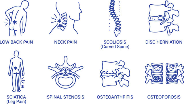 Spinal health conditions icons low back pain neck pain scoliosis disc herniation sciatica spinal stenosis osteoarthritis osteoporosis medical symbols.