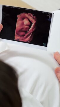 Expectant mother holding a 3d ultrasound image of her unborn child while lovingly caressing her pregnant belly, creating a tender and emotional moment of connection and anticipation