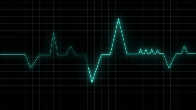 Heartbeat line graphs track cardiovascular telemetry metrics over dark grids. Emergency hospital monitor displays gain high technical authenticity. Pulse streams ripple.