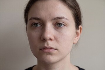 Fototapeta premium Close-up portrait of a young woman with natural skin texture and thoughtful expression, looking away.