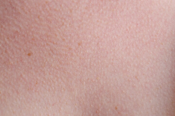 Fototapeta premium Texture of normal skin as background, closeup