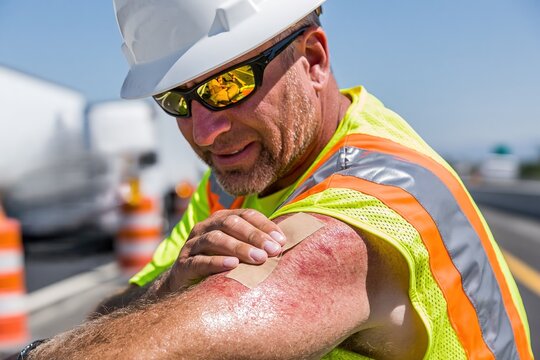 Construction Worker Applying Sunscreen to Forehead