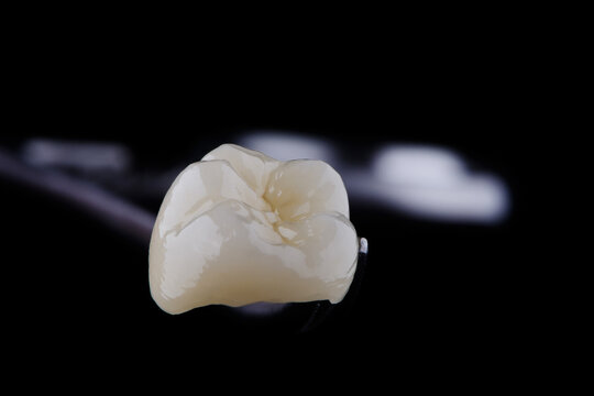 High-quality zirconia dental crown on white background. Dental ceramic crown professional dental lab
