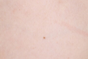 Fototapeta premium Texture of normal skin as background, closeup