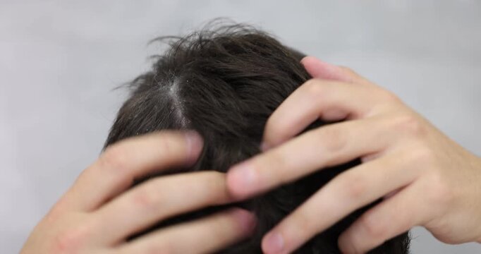 Dandruff problem. Man examining his head against blurred grey background, closeup. Camera moving forward and backwards
