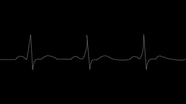 White Dotted Line ECG Heartbeat Pulse Wave Animation on Black Background , with video animation.