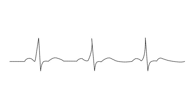 Minimalist Dotted Line Heartbeat ECG Waveform Motion Graphic Animation on White Background , with video animation.