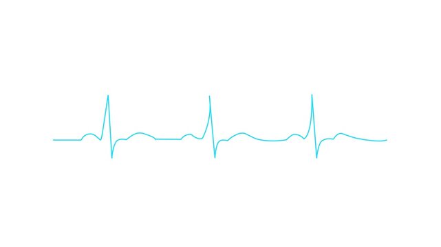 Smooth Cyan Blue Heartbeat Wave Motion Graphic Medical EKG Line Animation White Background