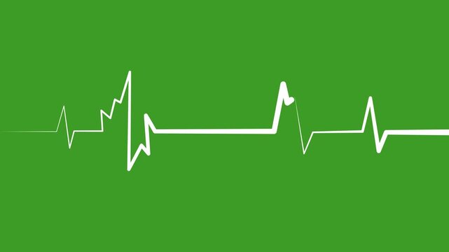 A clean white electrocardiogram line traces a heartbeat pattern on a black background,showing cardiogram line style motion graphics in loop ECG medical concept