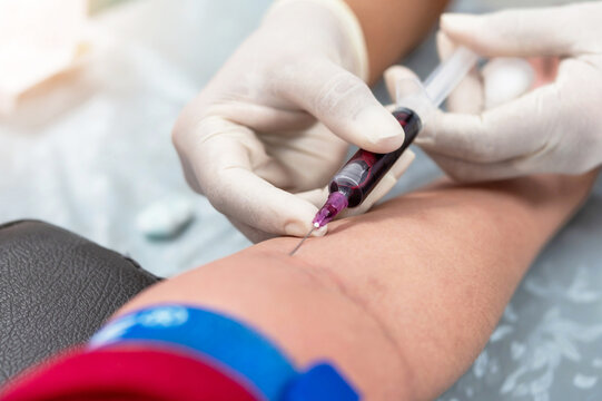 Healthcare Professional Collecting Blood Sample in Lab
