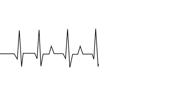 ECG line animation video on white background. Heartbeat electrocardiogram. ECG heartbeat monitor, ECG monitor, heart beating and pumping, healthcare medical animation.