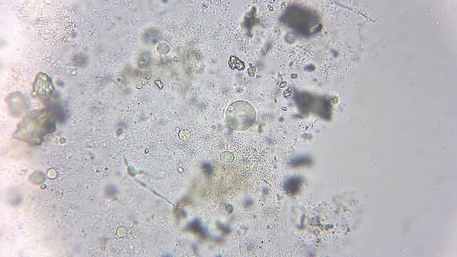 Colpoda ciliates under microscope, protozoa in cyst stage and active swimming organisms at 400x magnification, brightfield microscopy