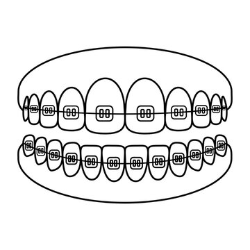Tooth braces icon, Full mouth braces, Tooth with braces, Dental braces, orthodontic, Element for product packaging logo, isolated on white for web and app. Flat vector illustration