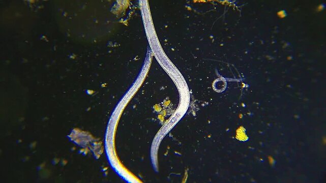Nematode roundworms moving through a dirty water droplet, microscopic darkfield view at 40x magnification
