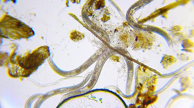 Nematode roundworms colony with internal eggs visible, swimming in water sample at 100x magnification, brightfield microscopy