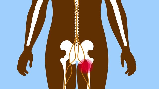 Human nerve pain tailbone pain and spinal disc disorder medical anatomy illustration