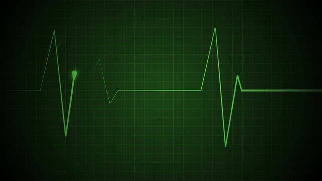 Heartbeat monitor line on a grid with a flat pulse and sharp spikes animation, showing a medical emergency or heartbeat concept