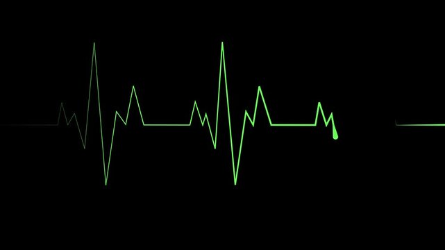 Heartbeat line sharp spikes and flat sections minimal abstract medical pulse design animation